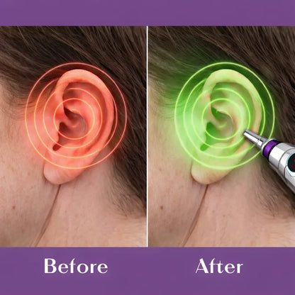 Acupuncture Massager